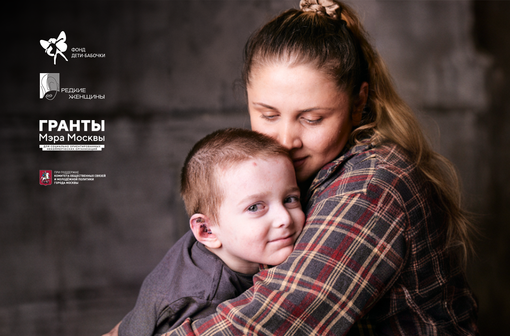 Фонд «Дети-бабочки» получил грант Мэра Москвы на развитие проекта «Редкие женщины»