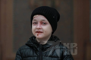 Боль от малейшего прикосновения: мама «мальчика-бабочки» из Дагестана рассказала, как живет сын с неизлечимой болезнью