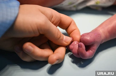 В Бурятии родились братья с необычной внешностью